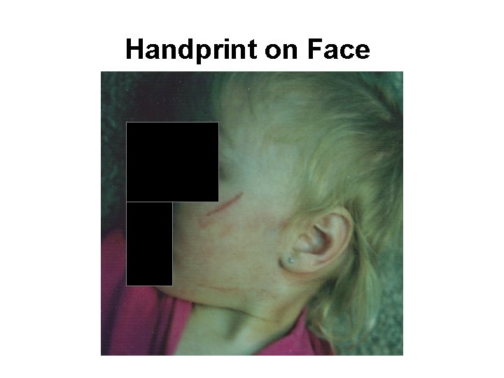 Handprint on Face 