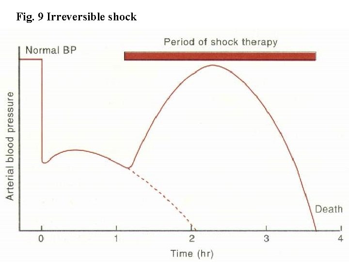 Fig. 9 Irreversible shock Fig. 9 Irreversible shock