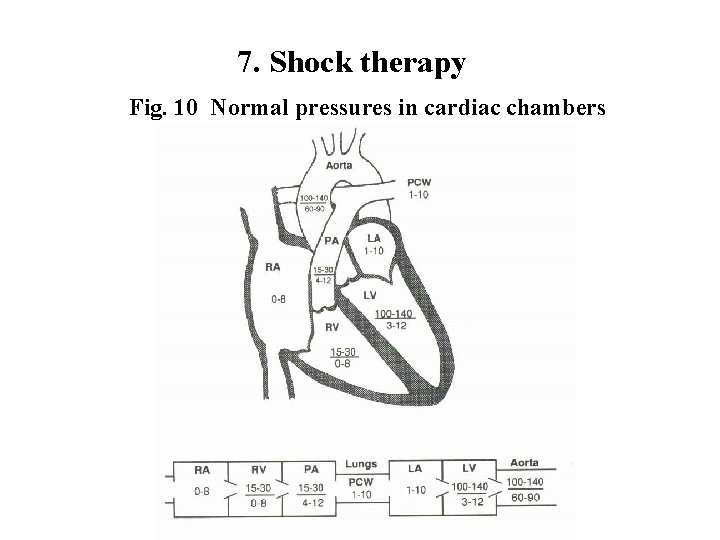 7. Shock therapy Fig. 10 Normal pressures in cardiac chambers 7. Shock therapy Fig. 10 Normal pressures in cardiac chambers