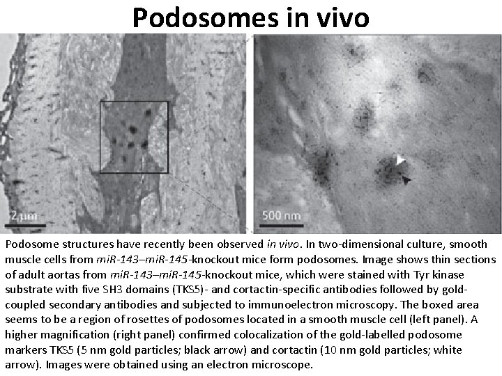 Podosomes in vivo Podosome structures have recently been observed in vivo. In two dimensional