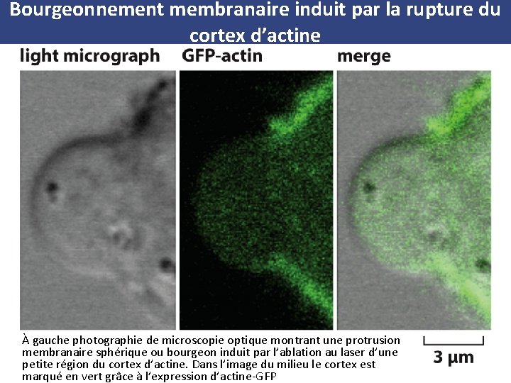 Bourgeonnement membranaire induit par la rupture du cortex d’actine À gauche photographie de microscopie