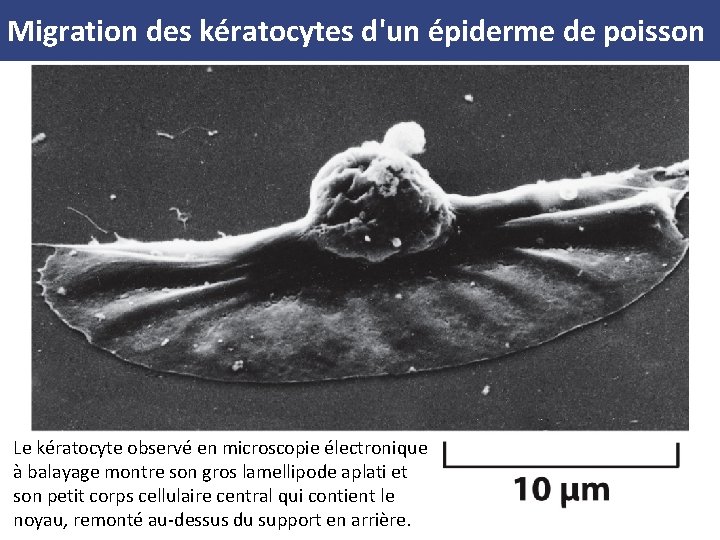 Migration des kératocytes d'un épiderme de poisson Le kératocyte observé en microscopie électronique à