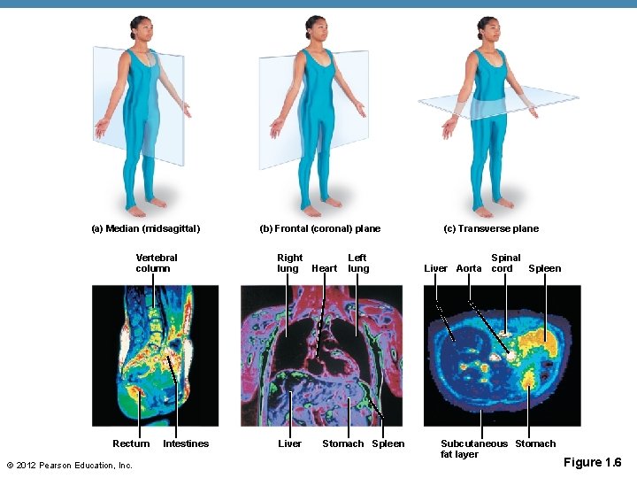 (a) Median (midsagittal) Vertebral column Rectum © 2012 Pearson Education, Inc. Intestines (b) Frontal