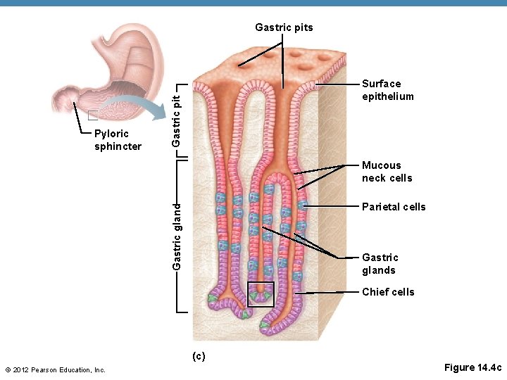 Gastric pits Gastric pit Pyloric sphincter Surface epithelium Mucous neck cells Gastric gland Parietal