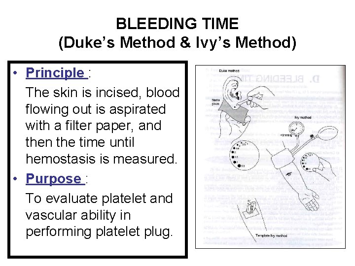 BLEEDING TIME (Duke’s Method & Ivy’s Method) • Principle : The skin is incised,