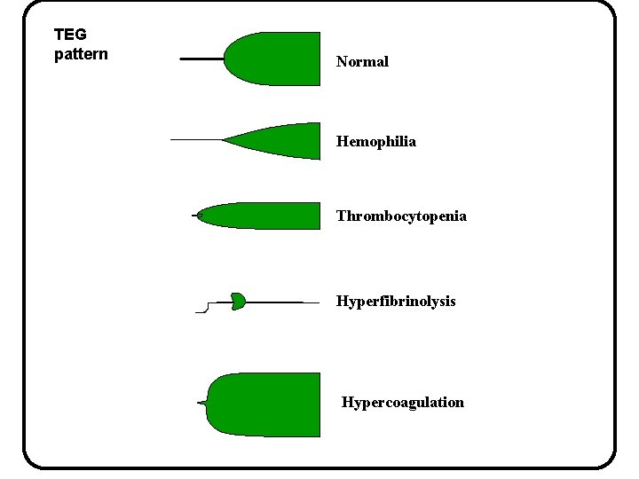 TEG pattern Normal Hemophilia Thrombocytopenia Hyperfibrinolysis Hypercoagulation 