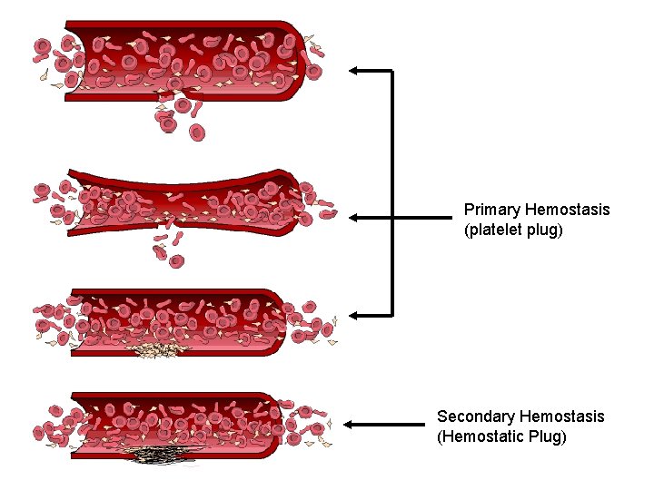 Primary Hemostasis (platelet plug) Secondary Hemostasis (Hemostatic Plug) 