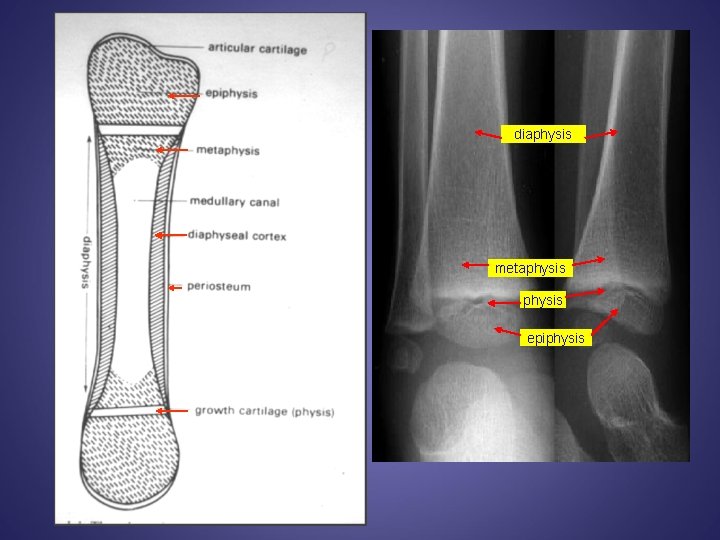 diaphysis metaphysis epiphysis 