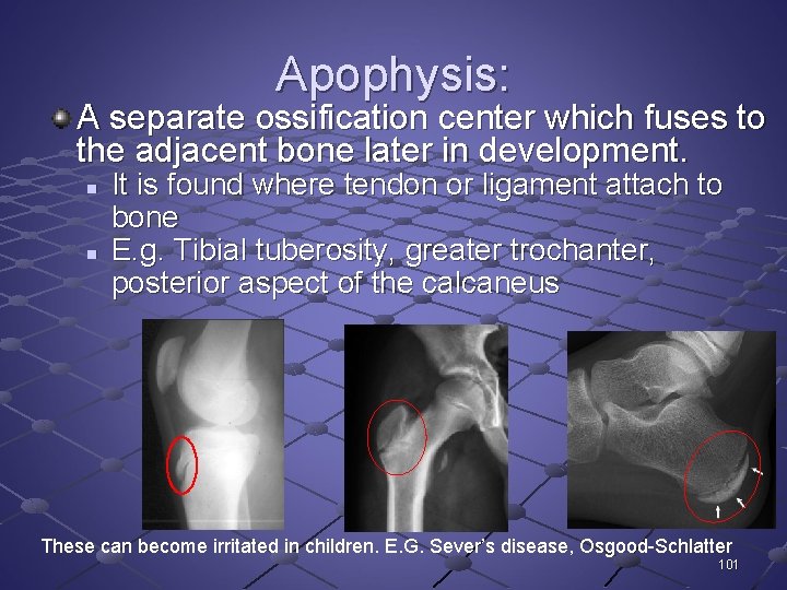 Apophysis: A separate ossification center which fuses to the adjacent bone later in development.