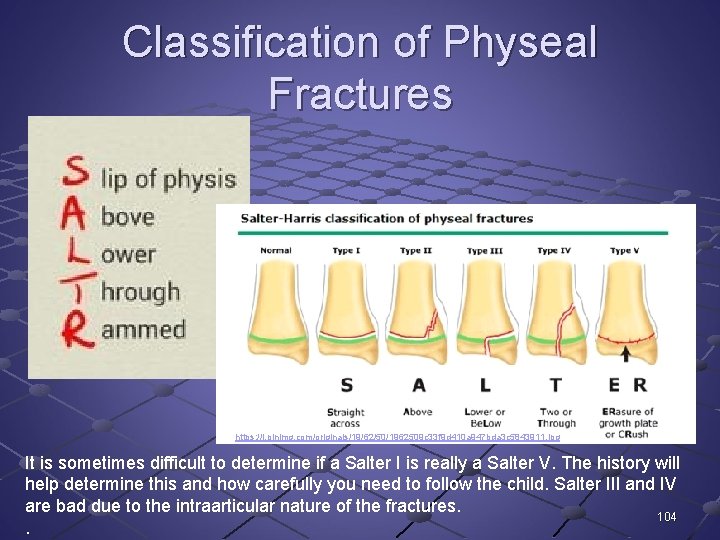 Classification of Physeal Fractures https: //i. pinimg. com/originals/19/62/50/1962509 c 33 f 9 d 410
