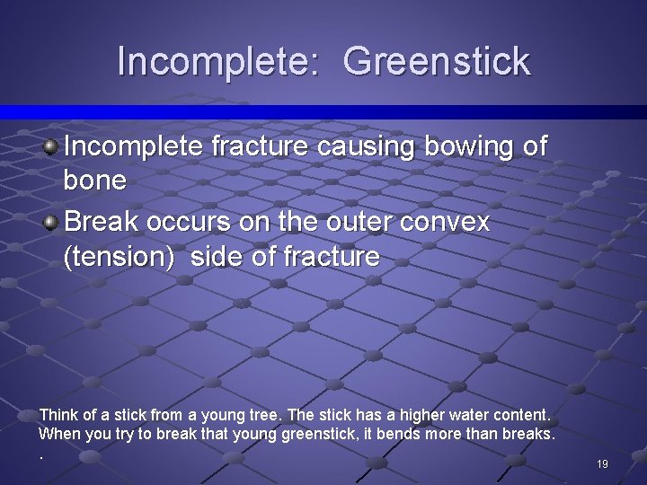 Incomplete: Greenstick Incomplete fracture causing bowing of bone Break occurs on the outer convex