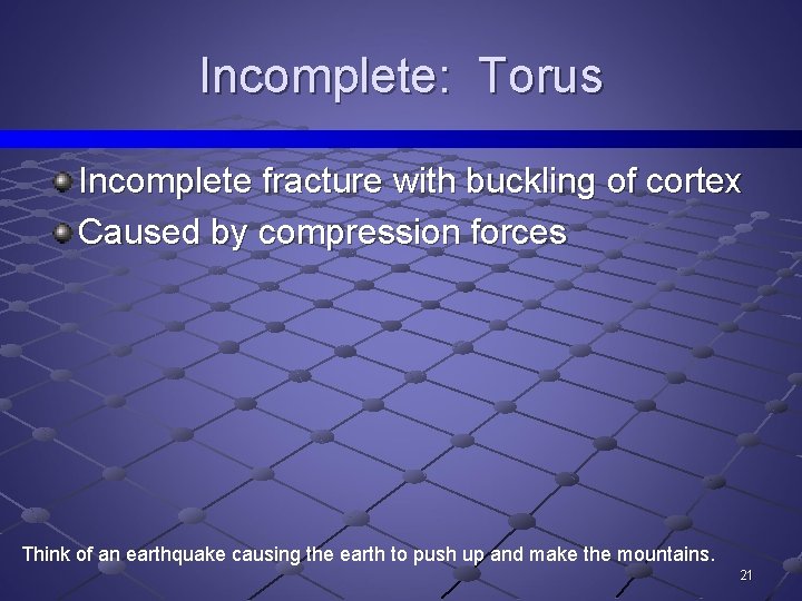Incomplete: Torus Incomplete fracture with buckling of cortex Caused by compression forces Think of