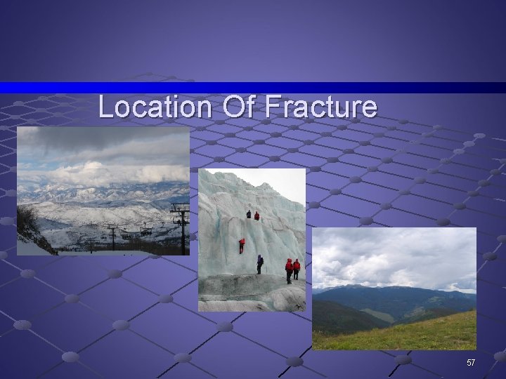 Location Of Fracture 57 