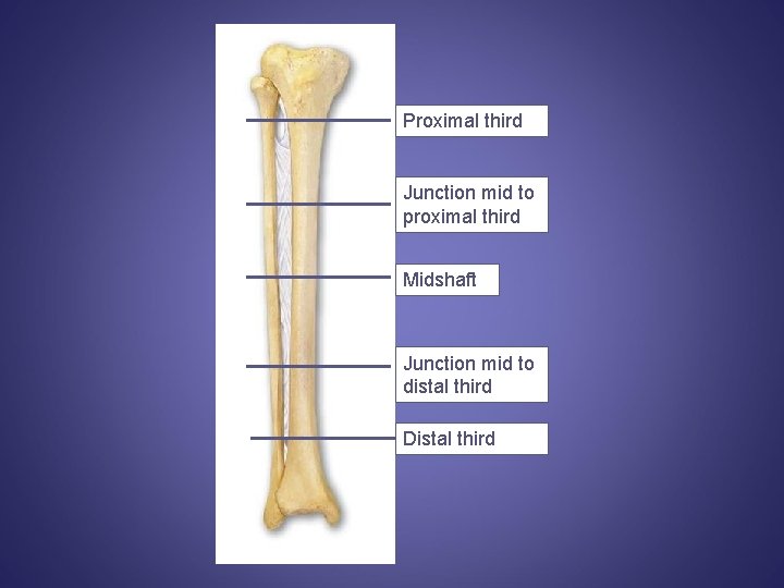 Proximal third Junction mid to proximal third Midshaft Junction mid to distal third Distal