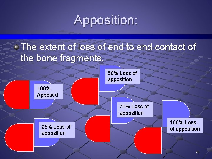 Apposition: The extent of loss of end to end contact of the bone fragments.