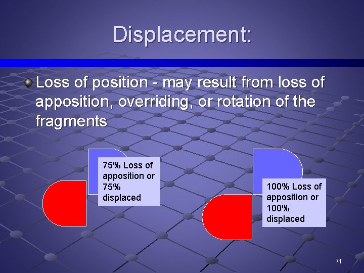 Displacement: Loss of position - may result from loss of apposition, overriding, or rotation