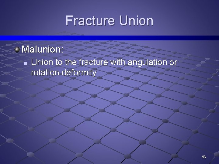 Fracture Union Malunion: n Union to the fracture with angulation or rotation deformity 96