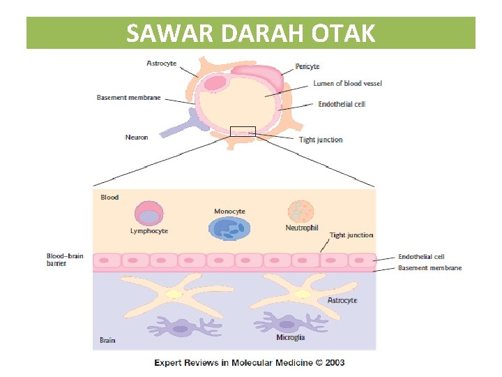 SAWAR DARAH OTAK 