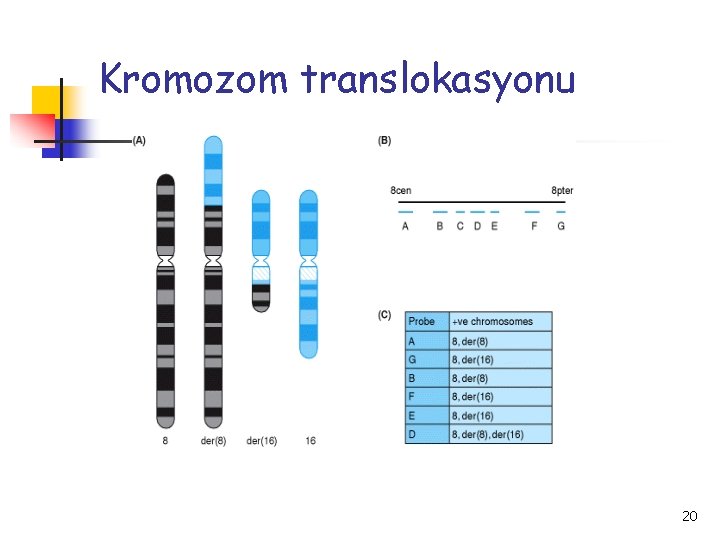 Kromozom translokasyonu 20 