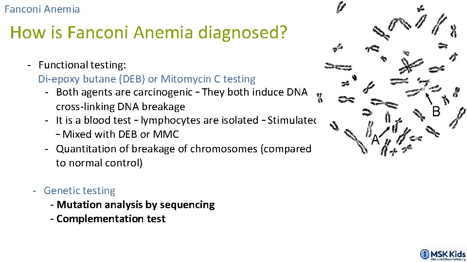 Fanconi Anemia How is Fanconi Anemia diagnosed? - Functional testing: Di-epoxy butane (DEB) or