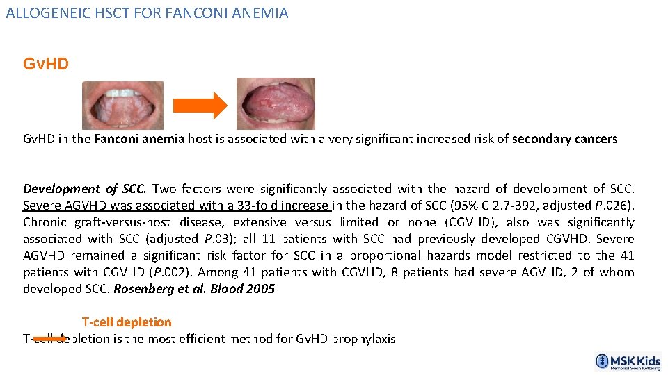 ALLOGENEIC HSCT FOR FANCONI ANEMIA Gv. HD in the Fanconi anemia host is associated