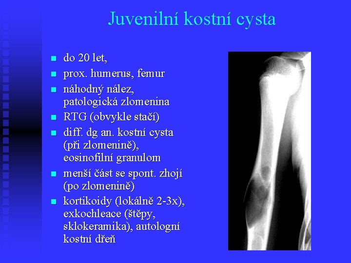 Juvenilní kostní cysta n n n n do 20 let, prox. humerus, femur náhodný