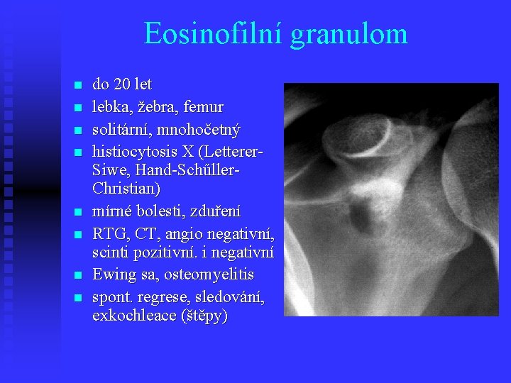 Eosinofilní granulom n n n n do 20 let lebka, žebra, femur solitární, mnohočetný