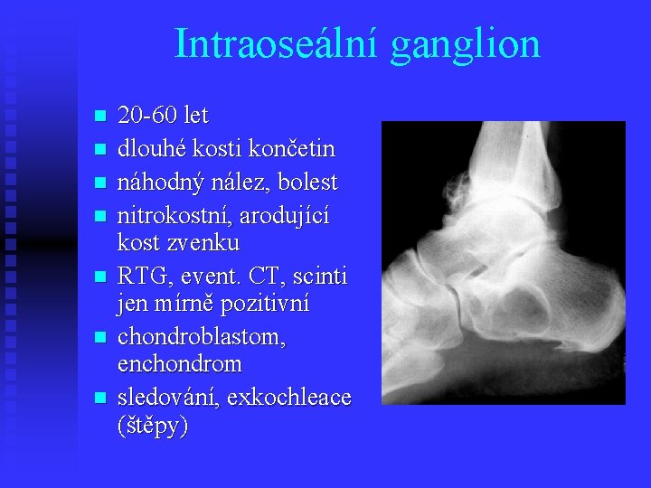 Intraoseální ganglion n n n 20 -60 let dlouhé kosti končetin náhodný nález, bolest