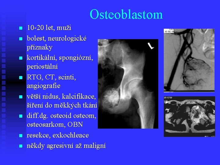 Osteoblastom n n n n 10 -20 let, muži bolest, neurologické příznaky kortikální, spongiózní,