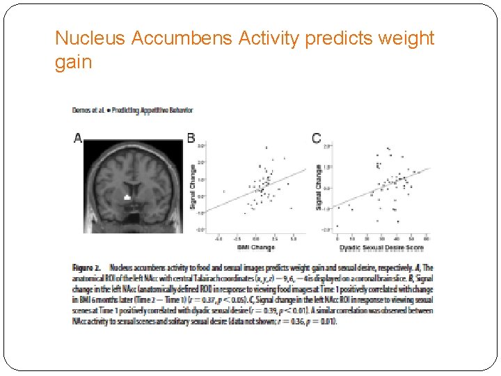 Nucleus Accumbens Activity predicts weight gain 