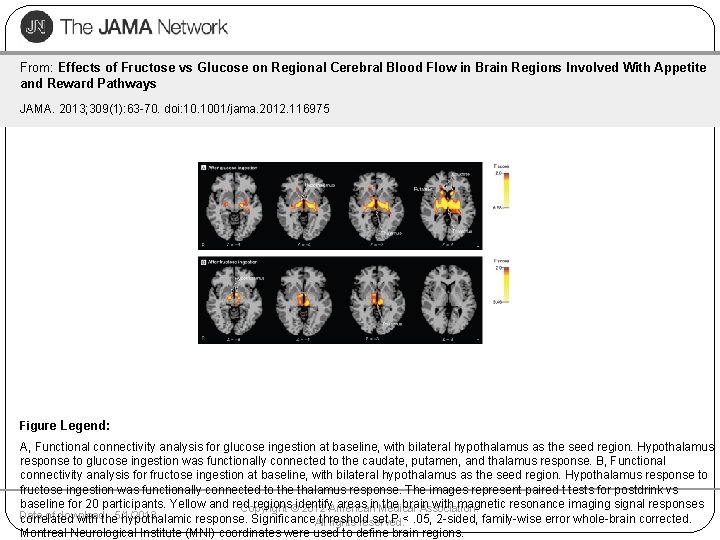 From: Effects of Fructose vs Glucose on Regional Cerebral Blood Flow in Brain Regions