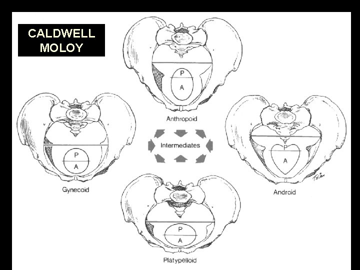 CALDWELL MOLOY 