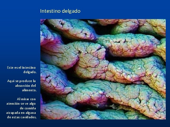 Intestino delgado Este es el intestino delgado. Aquí se produce la absorción del alimento.