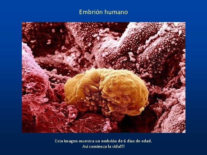 Embrión humano Esta imagen muestra un embrión de 6 días de edad. Así comienza