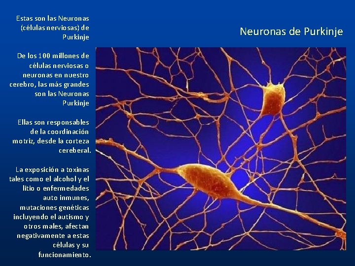 Estas son las Neuronas (células nerviosas) de Purkinje De los 100 millones de células