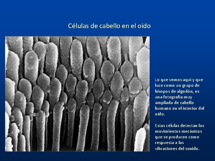 Células de cabello en el oído Lo que vemos aquí y que luce como