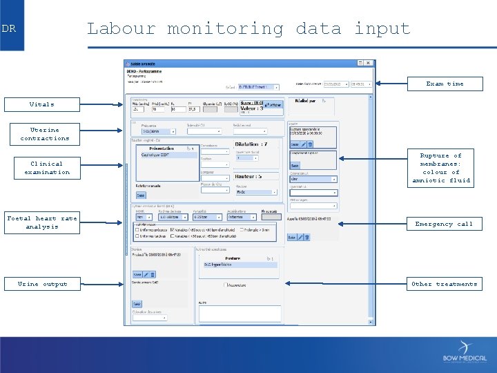 Labour monitoring data input DR Exam time Vitals Uterine contractions Clinical examination Rupture of