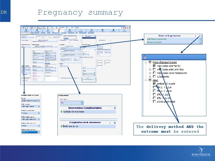 DR Pregnancy summary The delivery method AND the outcome must be entered 