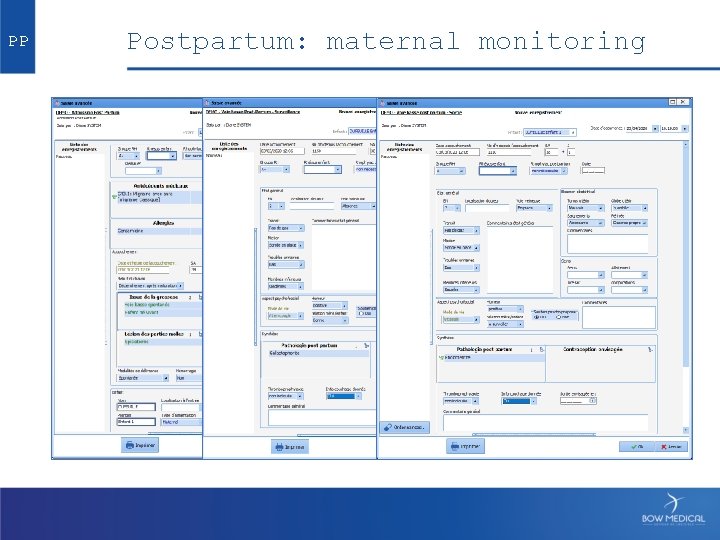 PP Postpartum: maternal monitoring 