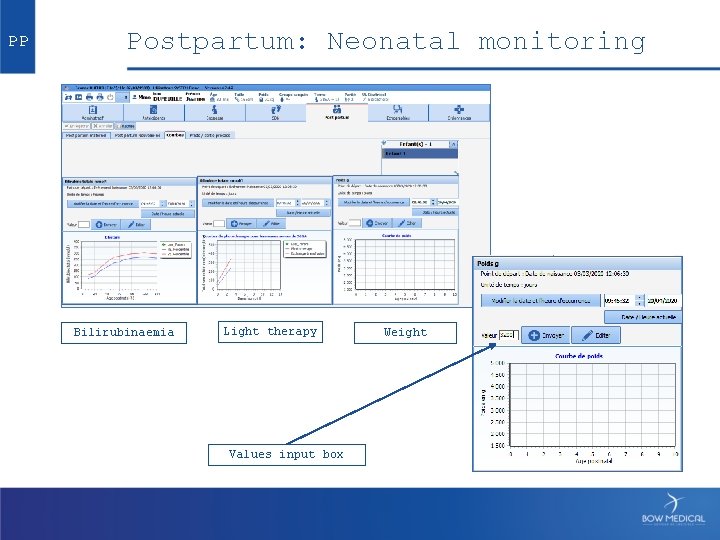 PP Postpartum: Neonatal monitoring Bilirubinaemia Light therapy Values input box Weight 