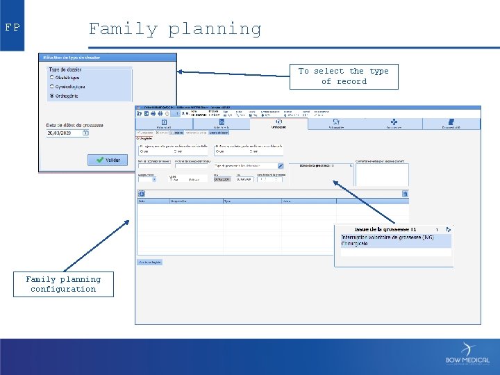 FP Family planning To select the type of record Family planning configuration 