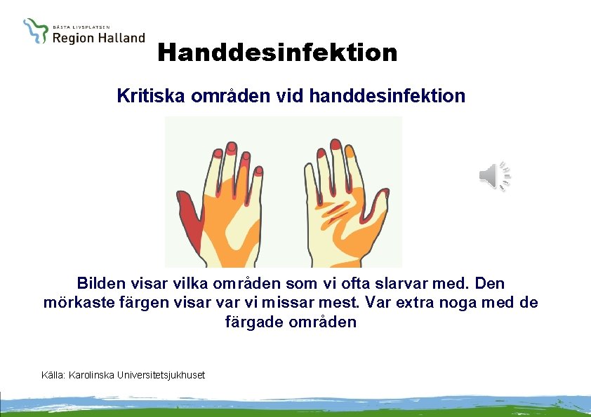 Handdesinfektion Kritiska områden vid handdesinfektion Bilden visar vilka områden som vi ofta slarvar med.