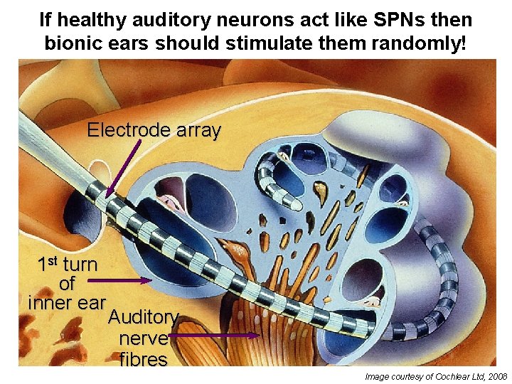 If healthy auditory neurons act like SPNs then bionic ears should stimulate them randomly! If healthy auditory neurons act like SPNs then bionic ears should stimulate them randomly!