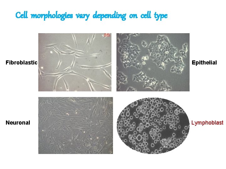 Cell morphologies vary depending on cell type Fibroblastic Epithelial Neuronal Lymphoblast 
