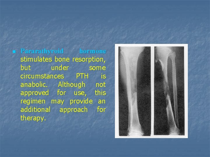 n Pararathyroid hormone stimulates bone resorption, but under some circumstances PTH is anabolic. Although