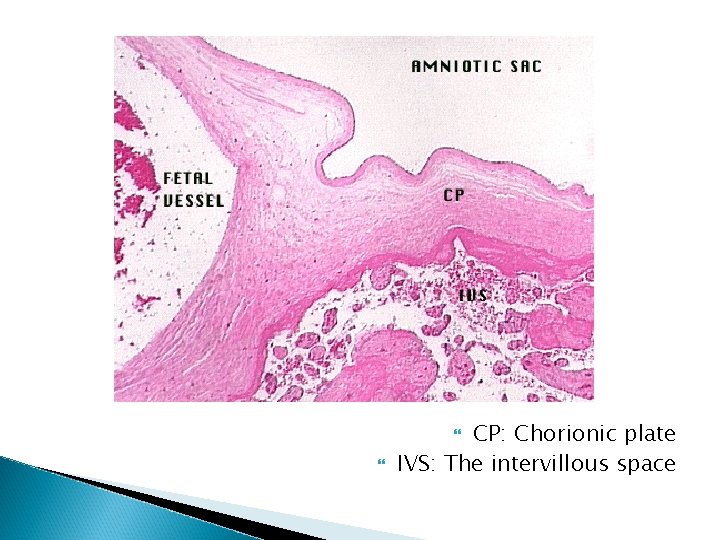 CP: Chorionic plate IVS: The intervillous space 