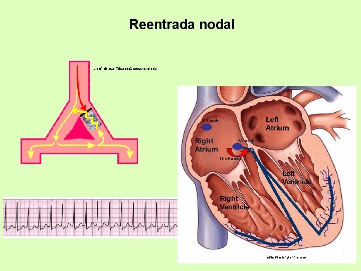 Reentrada nodal Modif. de http: //davidge 2. umaryland. edu www. washingtonhra. com 