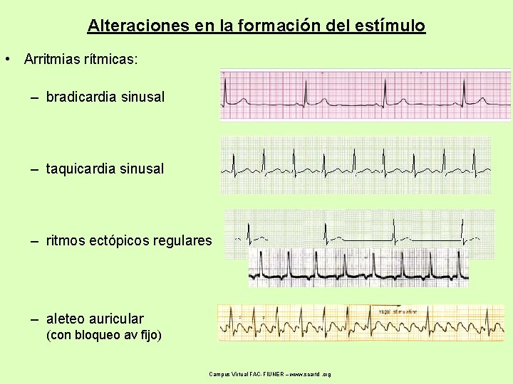 Alteraciones en la formación del estímulo • Arritmias rítmicas: – bradicardia sinusal – taquicardia