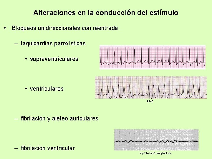 Alteraciones en la conducción del estímulo • Bloqueos unidireccionales con reentrada: – taquicardias paroxísticas