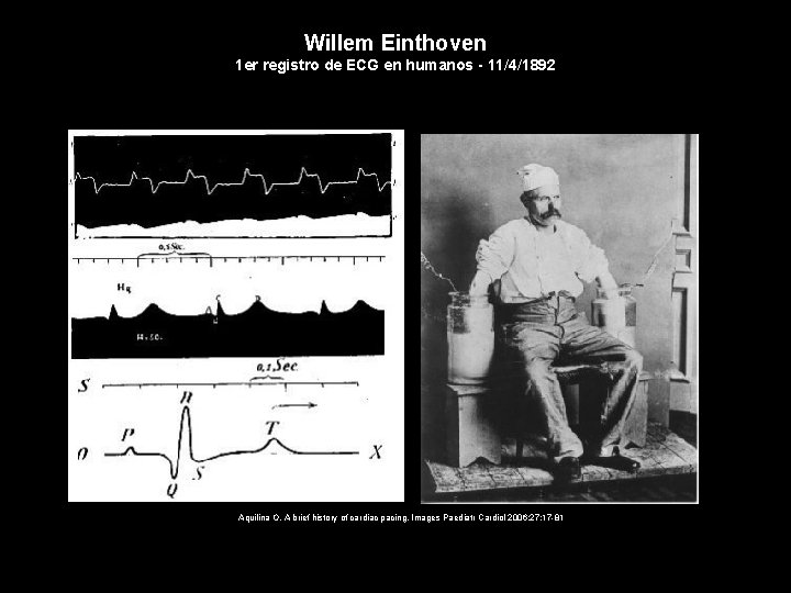 Willem Einthoven 1 er registro de ECG en humanos - 11/4/1892 Aquilina O. A